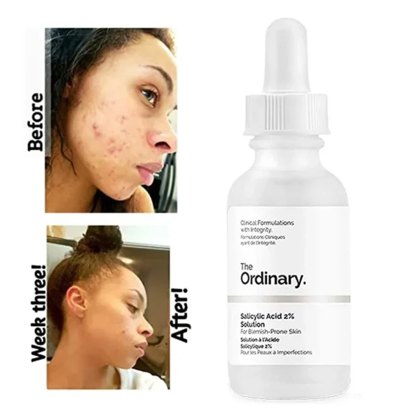The Ordinary Salicylic Acid 2 Solution - Image 2