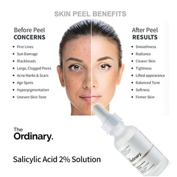 The Ordinary Salicylic Acid 2 Solution - Image 3